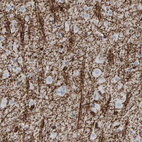 Anti-CNP Antibody