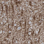 Immunohistochemical staining of human cerebral cortex shows strong positivity in neuronal processes.