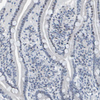 Immunohistochemical staining of human duodenum shows no positivity in glandular cells as expected.