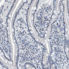 Anti-CNP Antibody