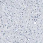 Immunohistochemical staining of human liver shows no positivity in hepatocytes as expected.
