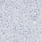 Immunohistochemical staining of human liver shows no positivity in hepatocytes as expected.