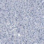 Anti-CNP Antibody