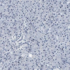 Immunohistochemical staining of human pancreas shows no positivity in exocrine glandular cells as expected.