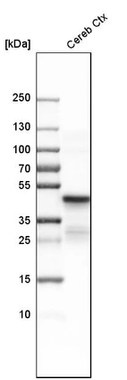 Western blot analysis in human cerebral cortex tissue.