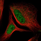 Immunofluorescent staining of human cell line U-2 OS shows localization to nucleoplasm & cytosol.