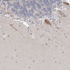 Anti-NIPA1 Antibody