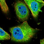 Immunofluorescent staining of human cell line U-251 MG shows localization to nucleoplasm & cytosol.