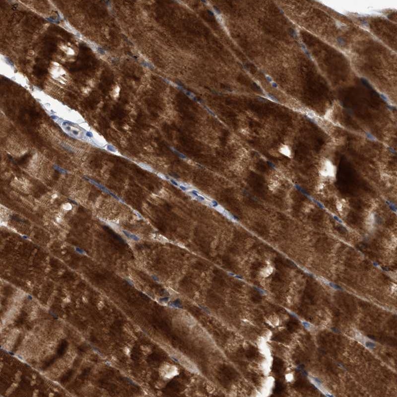 Anti-SEMA4D Antibody