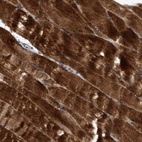 Anti-SEMA4D Antibody