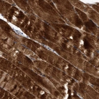 Anti-SEMA4D Antibody