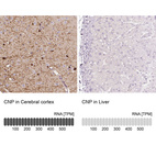 Anti-CNP Antibody