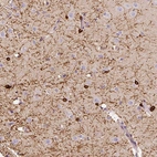 Immunohistochemical staining of human cerebral cortex shows strong cytoplasmic positivity in oligodendrocytes.