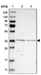 Lane 1: Marker [kDa] 230, 130, 95, 72, 56, 36, 28, 17, 11_br/_Lane 2: Human cell line RT-4_br/_Lane 3: Human cell line U-251MG sp