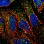 Immunofluorescent staining of human cell line U-2 OS shows positivity in cytoplasm.