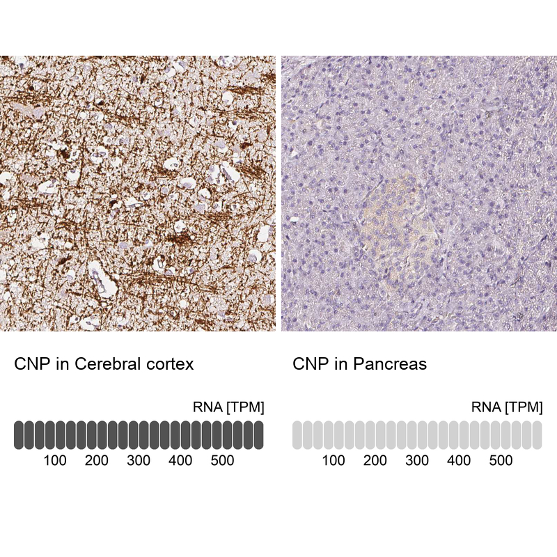 Anti-CNP Antibody