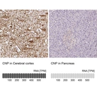 Anti-CNP Antibody