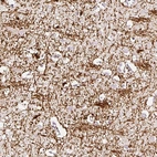 Immunohistochemical staining of human cerebral cortex shows strong positivity in neuronal processes.