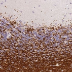 Immunohistochemical staining of human cerebellum shows strong positivity in neuronal processes in cells in granular layer.