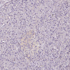 Anti-CNP Antibody