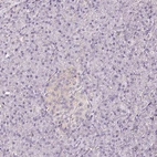 Immunohistochemical staining of human pancreas shows no positivity in exocrine glandular cells as expected.