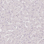 Anti-CNP Antibody