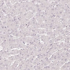 Immunohistochemical staining of human liver shows no positivity in hepatocytes as expected.