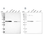 Western blot analysis using Anti-CNP antibody HPA023280 (A) shows similar pattern to independent antibody HPA023266 (B).
