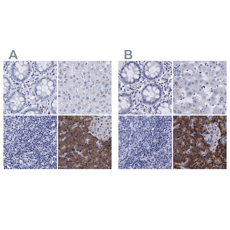 Anti-ARSG Antibody