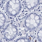 Immunohistochemical staining of human colon using Anti-ARSG antibody HPA023285.