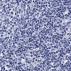 Immunohistochemical staining of human lymph node using Anti-ARSG antibody HPA023285.