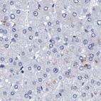 Immunohistochemical staining of human liver using Anti-ARSG antibody HPA023285.