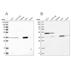 Western blot analysis using Anti-CRYZ antibody HPA023290 (A) shows similar pattern to independent antibody HPA021921 (B).