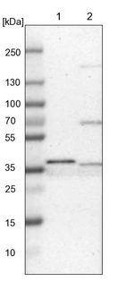 Lane 1: NIH-3T3 cell lysate (Mouse embryonic fibroblast cells)_br/_Lane 2: NBT-II cell lysate (Rat Wistar bladder tumour cells)