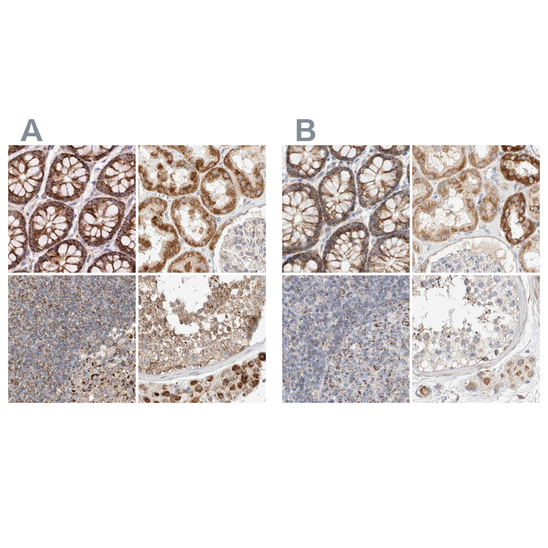 Anti-MRM3 Antibody