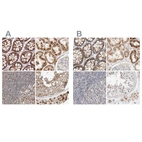 Anti-MRM3 Antibody