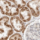 Immunohistochemical staining of human kidney using Anti-MRM3 antibody HPA023292.