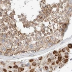 Immunohistochemical staining of human testis using Anti-MRM3 antibody HPA023292.