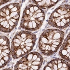 Immunohistochemical staining of human colon using Anti-MRM3 antibody HPA023292.
