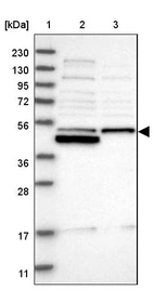 Lane 1: Marker [kDa] 230, 130, 95, 72, 56, 36, 28, 17, 11_br/_Lane 2: Human cell line RT-4_br/_Lane 3: Human cell line U-251MG sp