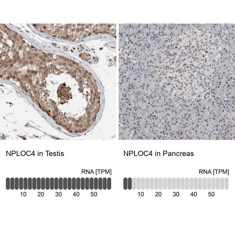 Anti-NPLOC4 Antibody