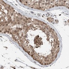 Immunohistochemical staining of human testis shows high expression.
