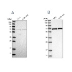 Western blot analysis using Anti-NPLOC4 antibody HPA023295 (A) shows similar pattern to independent antibody HPA021560 (B).