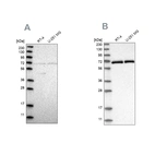 Western blot analysis using Anti-NPLOC4 antibody HPA023295 (A) shows similar pattern to independent antibody HPA021560 (B).
