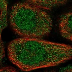 Immunofluorescent staining of human cell line A-431 shows localization to nucleoplasm & cytosol.