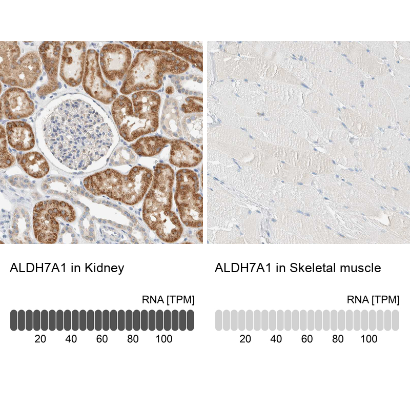 Anti-ALDH7A1 Antibody