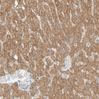 Immunohistochemical staining of human liver shows moderate positivity in cytoplasm granular in hepatocytes.