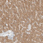 Anti-ALDH7A1 Antibody