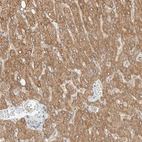 Immunohistochemical staining of human liver shows moderate positivity in cytoplasm granular in hepatocytes.