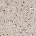 Immunohistochemical staining of human cerebral cortex shows moderate membranous positivity in microglia.
